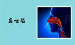 鼻咽癌早期症状有哪些?