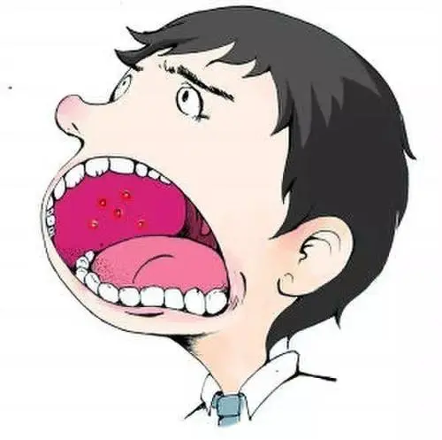 杭州御和堂中医：口腔癌的早期症状是什么。