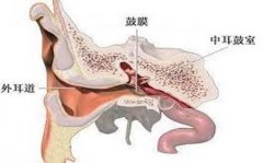 耳剧痛需警惕 急性大疱性鼓膜炎!